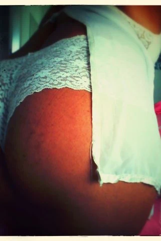 Acompanhante CasalBihLiberal⚡🔥🍺🍼