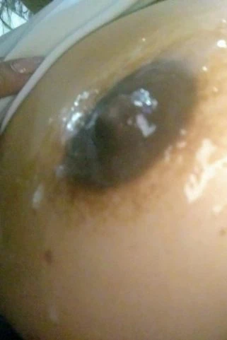 Acompanhante CasalBihLiberal⚡🔥🍺🍼